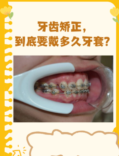 南医大口腔医院矫正牙齿价格多少？2025实测价表+省钱攻略，公办医院不花冤枉钱