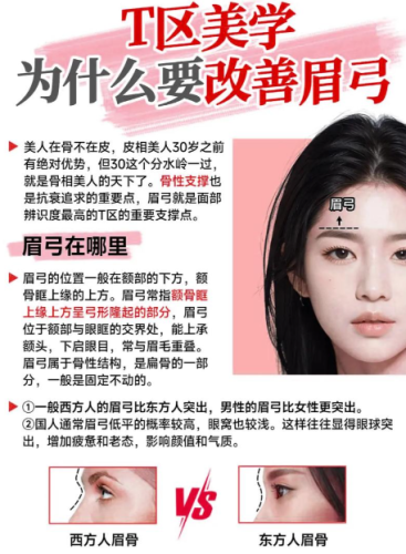 填眉弓的好处：不止显立体！5大核心优势+真实案例，颜值气质双逆袭
