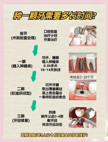 北京协和医院种牙怎么样？3类真实案例+2025实测价表+学术支撑，缺牙党必看
