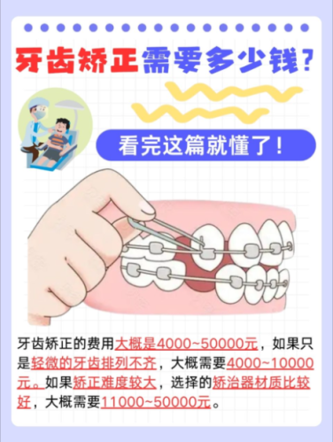 广东省中医院牙齿矫正价格2025揭秘！三甲中医特色+8800元起，学生党也能冲