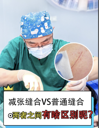 减张缝合和一般缝合区别大揭秘,3类伤口选对不踩雷