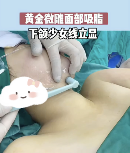 水动力吸脂和黄金微雕哪个更适合吸大腿胳膊脂肪？到底选哪个不踩雷