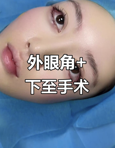 做外眼角和下至眼睛出现水泡？3大核心原因+急救方案全拆解