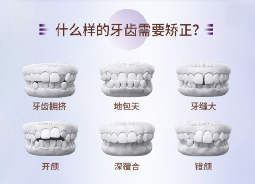 泉州柏德口腔牙齿矫正多少钱？3类主流方案差价5倍