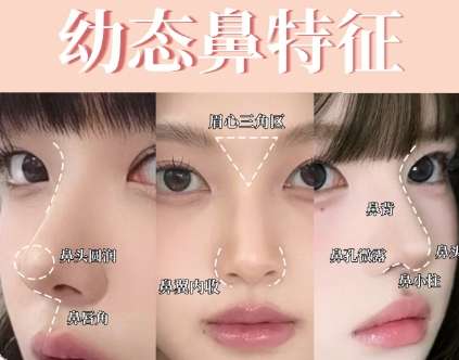 【鼻子整形咨询】隆鼻医院医生在线咨询预约