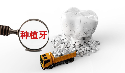 北京丰台种牙哪里比较好?深度测评:4家机构特色+病例+适配指南
