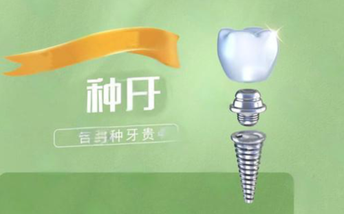 大渡口哪里看牙齿好?选对“适配方案”比选“贵的”更重要