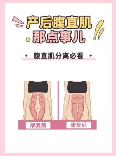 腹直肌收紧了肚子会小吗?2025医生实测:别再被伪科普骗了