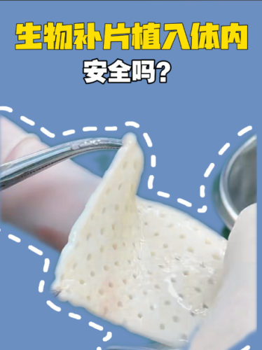 生物补片增粗多少钱？拆解费用构成：每一分钱都有去向