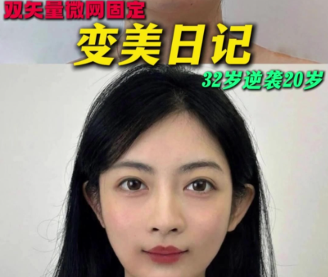 双矢量提升术多少钱？全球双矢量提升术费用对比