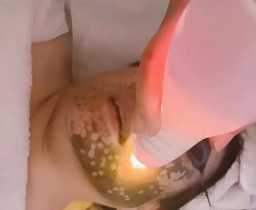 做黑脸娃娃有副作用吗?医美医生揭秘:这些禁忌一定要避开