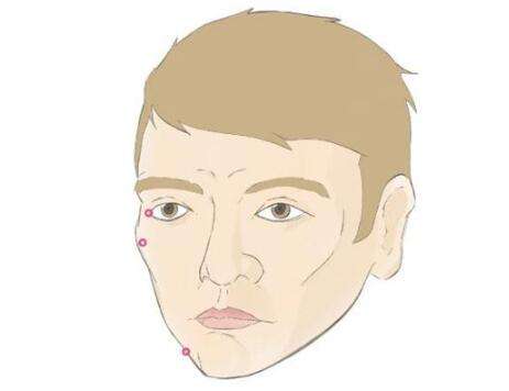 男生打注射瘦脸前后对比图怎么样？国字脸秒变帅气小V脸