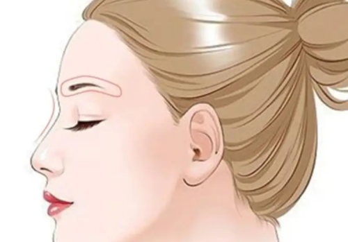 眉心三角填充需要多少钱?费用构成、维持时间和适合人群全说清楚