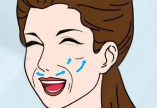 鼻唇沟填充玻尿酸多少钱？法令纹深浅不同，用量差距很大