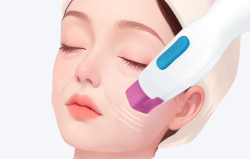 中面部下垂怎么改善？玻尿酸填充、线雕、手术提升效果对比分析