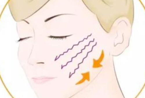 韧带提升和提升针哪个好?两种方式从原理到效果的深度对比