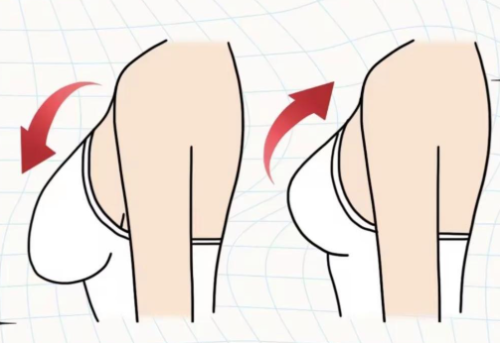 胸部悬吊术多少钱？影响最终费用的几个关键因素是什么？