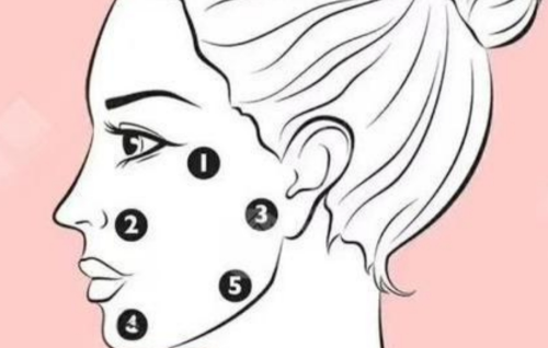 外轮廓提升是什么项目?项目原理、适应人群全解析