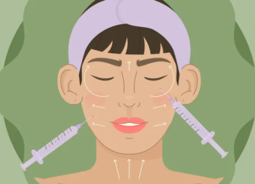 脂肪填充和胶原蛋白填充的区别，维持时间、触感、风险差异一次讲清