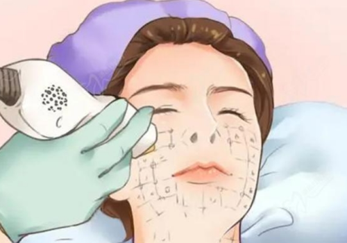 超声王和热玛吉哪个效果好？做之前必须搞清楚这几点核心差异