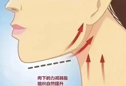 下颌缘和颈阔肌打了多久见效？这篇说清变化节奏