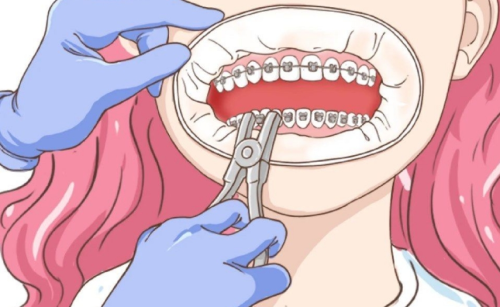 浙一正畸哪个医生好?经验方向和审美偏好先看清